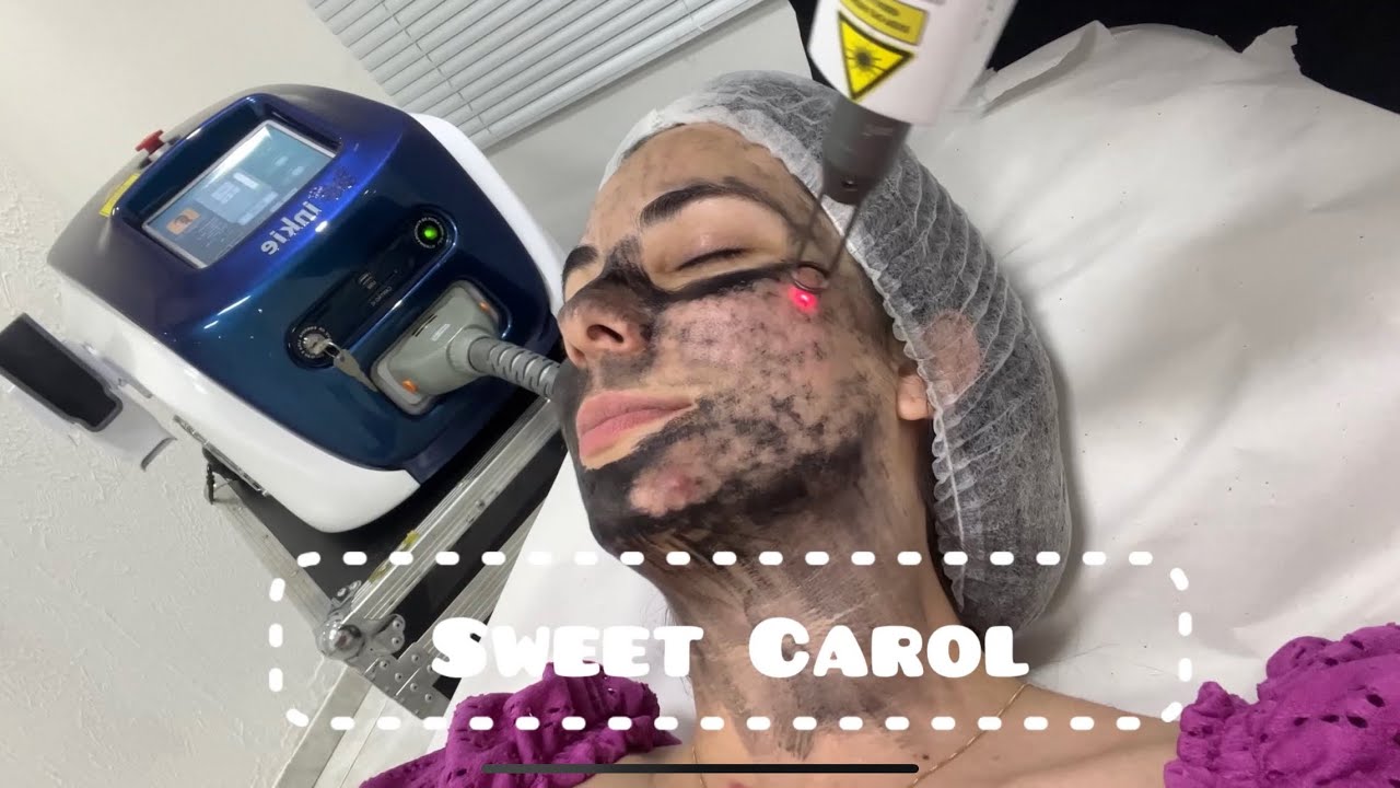 FIZ O BLACK PEEL (Peeling de Hollywood)