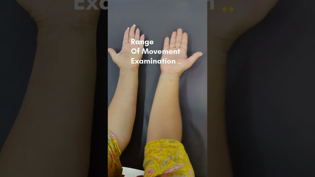 😱Hand After Fracture 💪💪💪 #shorts