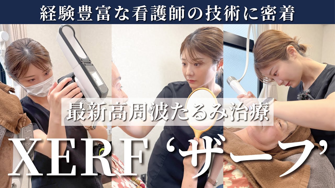 【看護師施術に密着】経験豊富な磯野看護師による最新高周波たるみ治療ザーフ！
