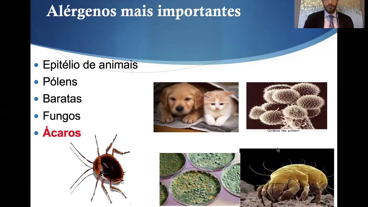 Rinite em criança /Infância. Quais as causas, como investigar e tratamento. Otorrino em Curitiba