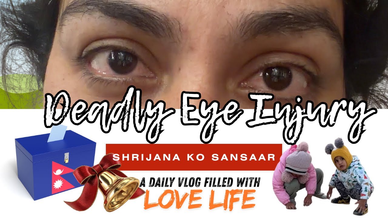 The deadly Eye Injury… #Pre_Election #nepal 