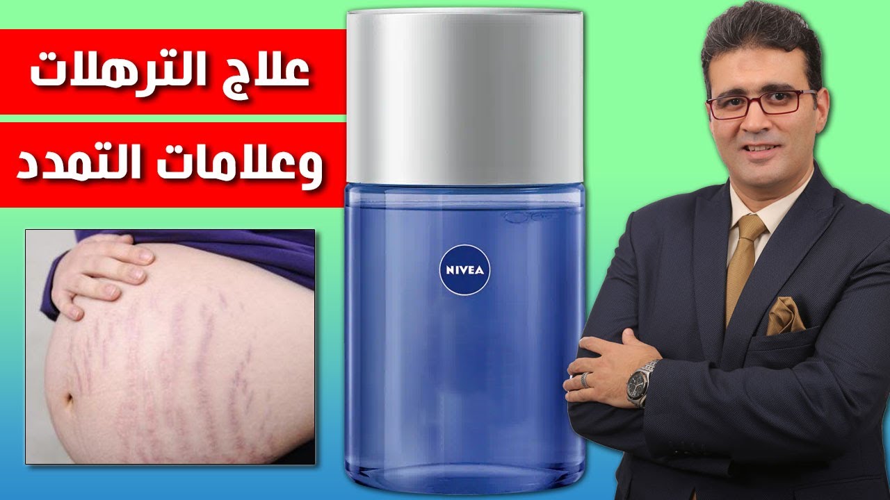 زيت تحفة من نيفيا .. للسترتش ماركس وشد ترهل البطن والصدر والأرداف