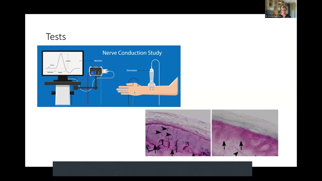 Clinical Manifestations of Neurosarcoidosis - Neurosarcoidosis Patient Day 2023
