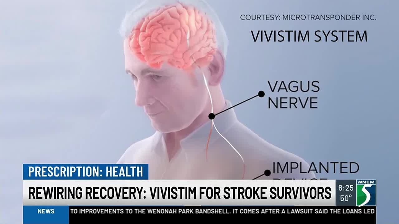 Rewiring Recovery: Vivistim for Stroke Survivors