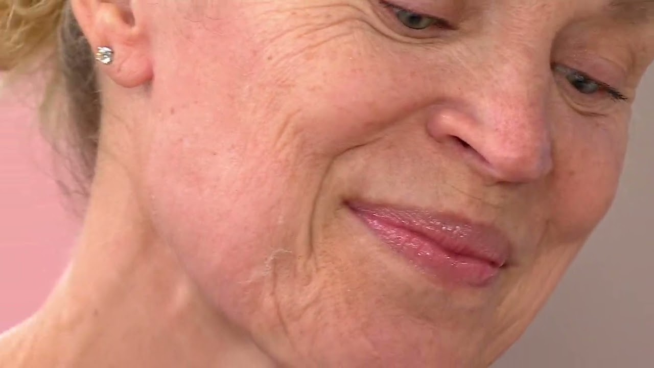 DERMAFLASH LUXE+ Anti-Aging Exfoliation Auto-Delivery on QVC
