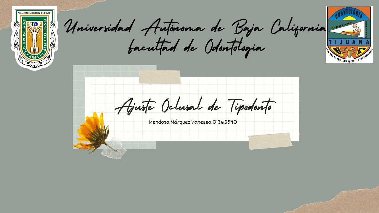 Ajuste Oclusal de Tipodonto