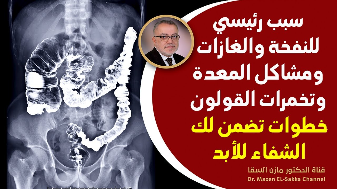 علاج النفخة وكثرة الغازات في البطن كيفية التخلص من انتفاخ البطن والام القولون والمعدة والغازات ؟