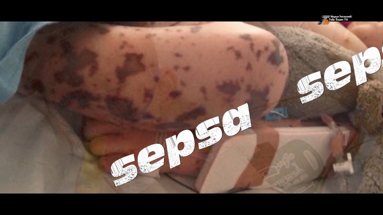 Bo zdrowie jest najważniejsze - sepsa...