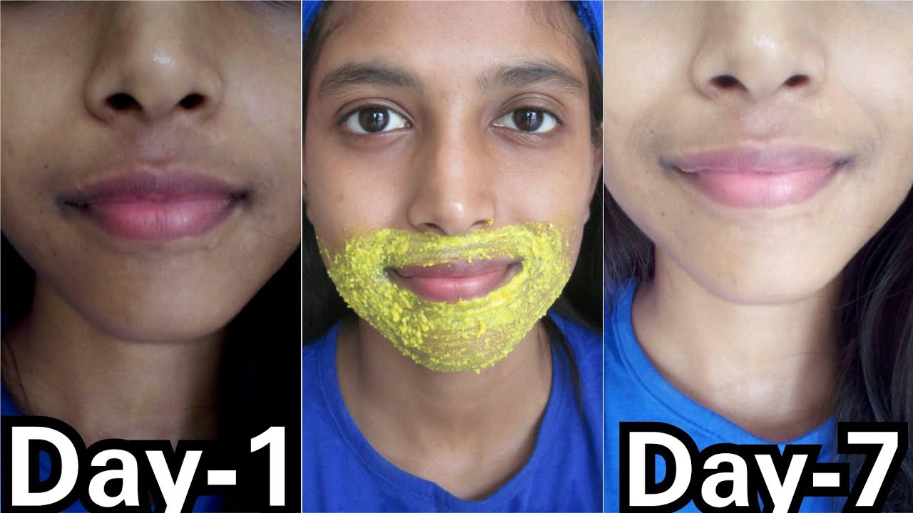 Remove Pigmentation, Dark patches Around Mouth 
|| 100% Result in 3 Use ||