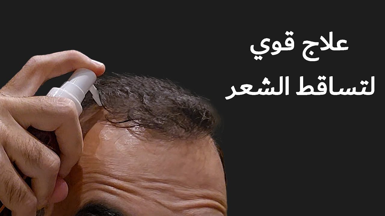 علاج قوي جدا وسهل لتساقط الشعر