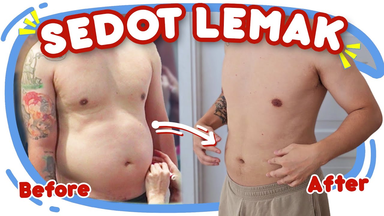 Sedot Lemak di tempat Reality Show Korea