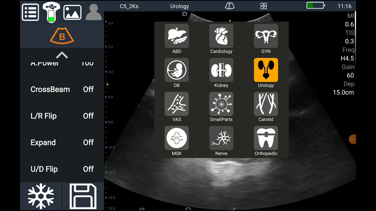 Bladder Volume Measurement for Android