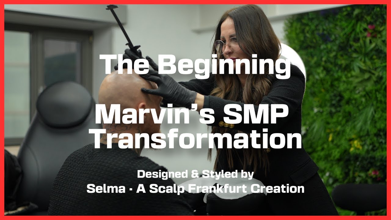 The Beginning – Marvin’s SMP Transformation | 1  Sitzung Haarpigmentierung