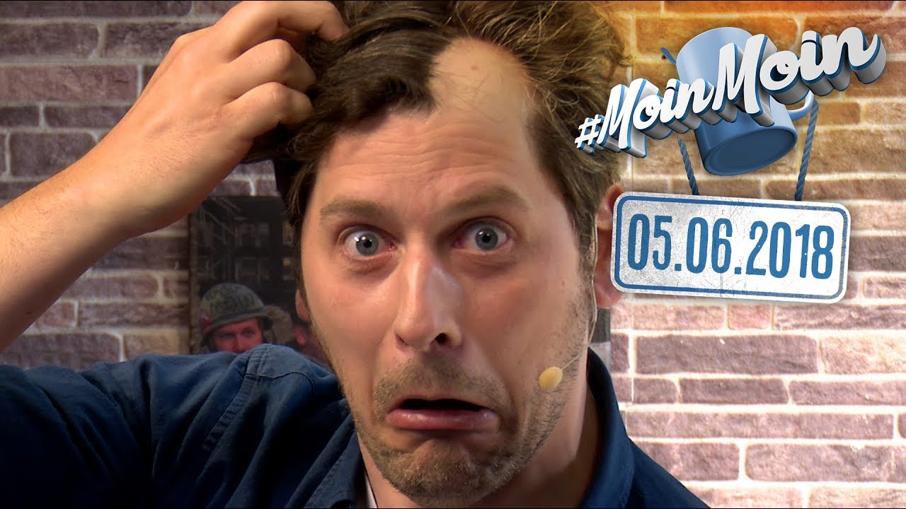 Stress, Burnout & Alopecia Areata | MoinMoin mit Simon & Budi