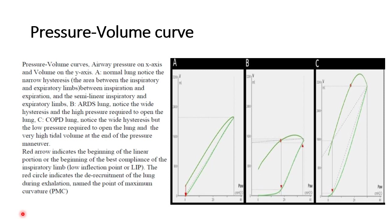 Basics of Mechanical Ventilation  Part 1: Respiratory Mechanics - Waveforms