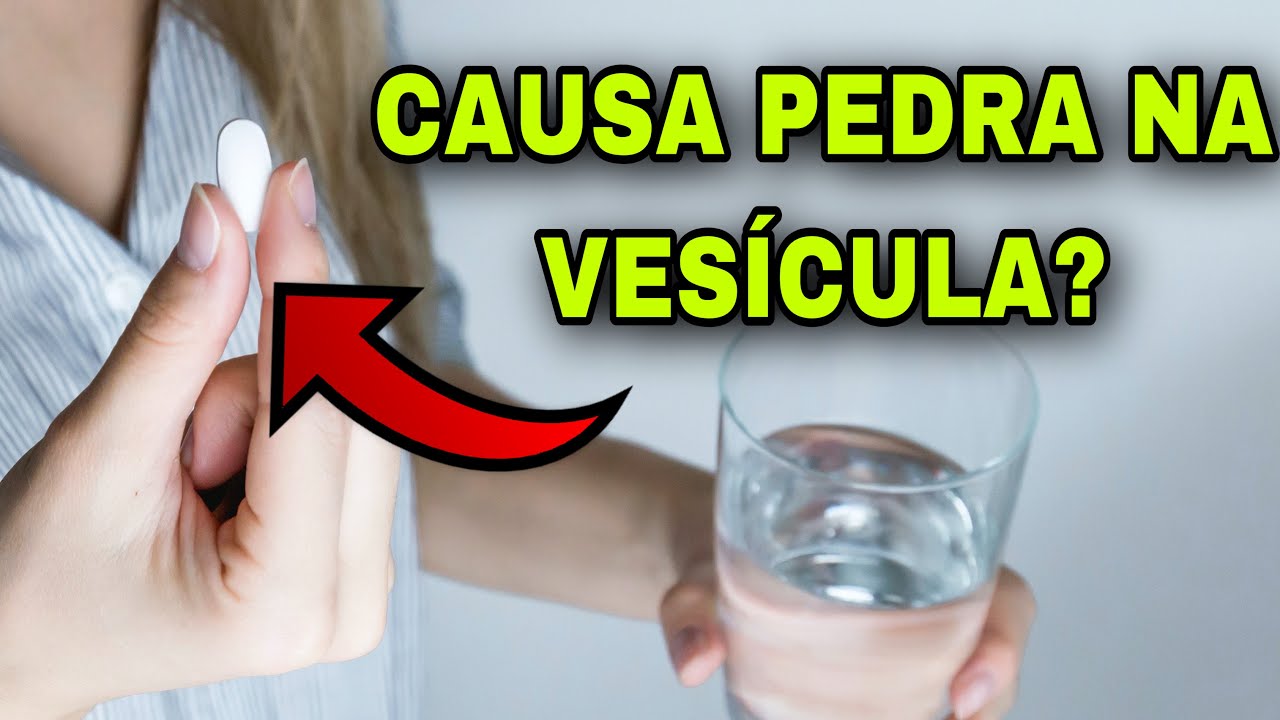 8 REMÉDIOS QUE PODEM CAUSAR PEDRA NA VESÍCULA | COLELITÍASE