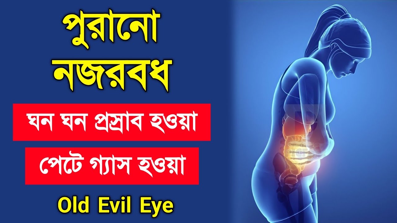 🔥পুরানো নজরবধ এর লক্ষ্মণ এবং তার চিকিৎসা | বারবার প্রস্রাব হওয়া এবং গ্যাস হওয়া | Old Evil Eye - ik