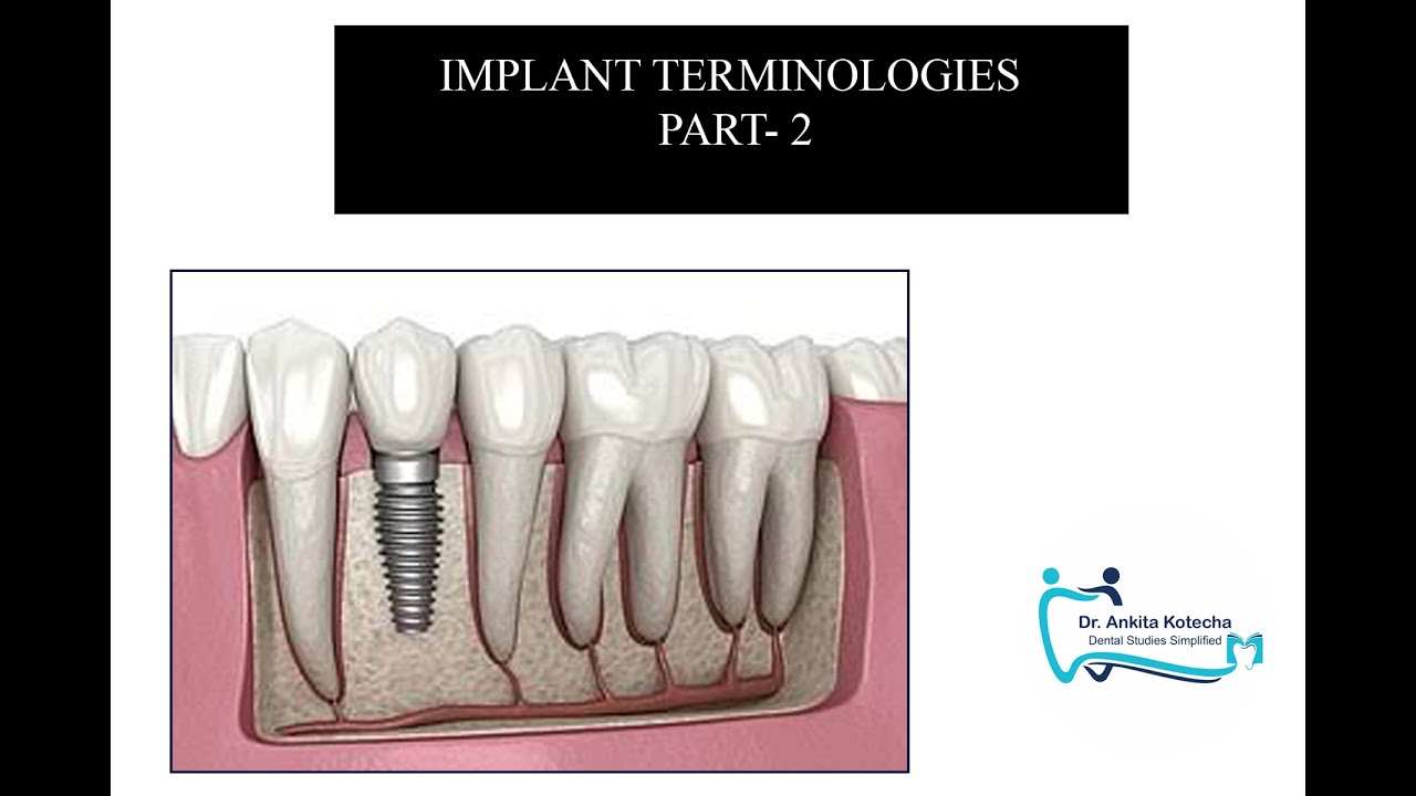 3. IMPLANT TERMINOLOGIES part 2| IMPLANTS| PERIODONTICS| DR. ANKITA KOTECHA