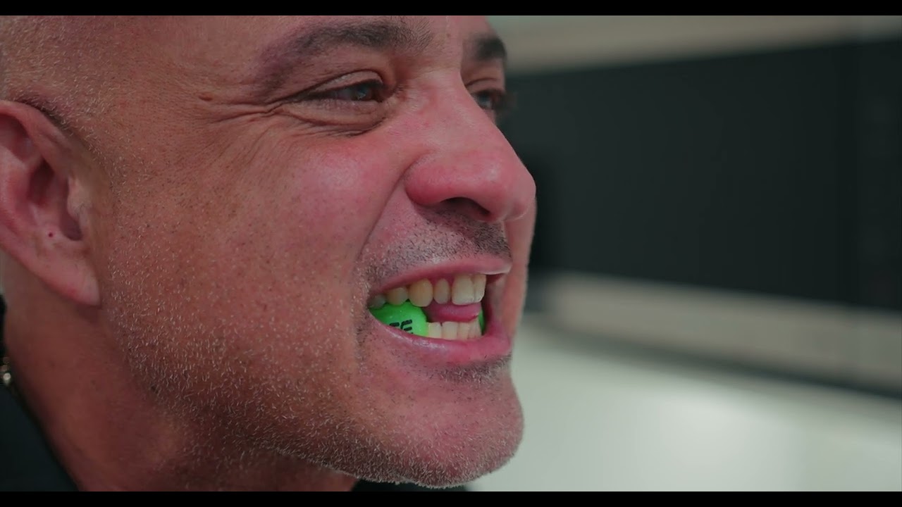 NAP 5DS Universal & Mid Profile Mouthpiece Fitting Instructions
