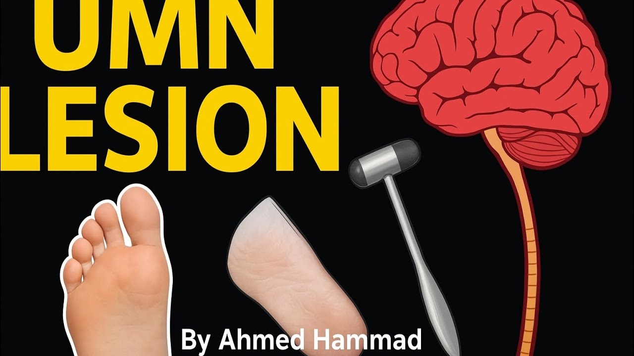 Upper Motor Neuron Lesion (UMNL): Causes, Symptoms, and Clinical Findings | Neurology Made Simple