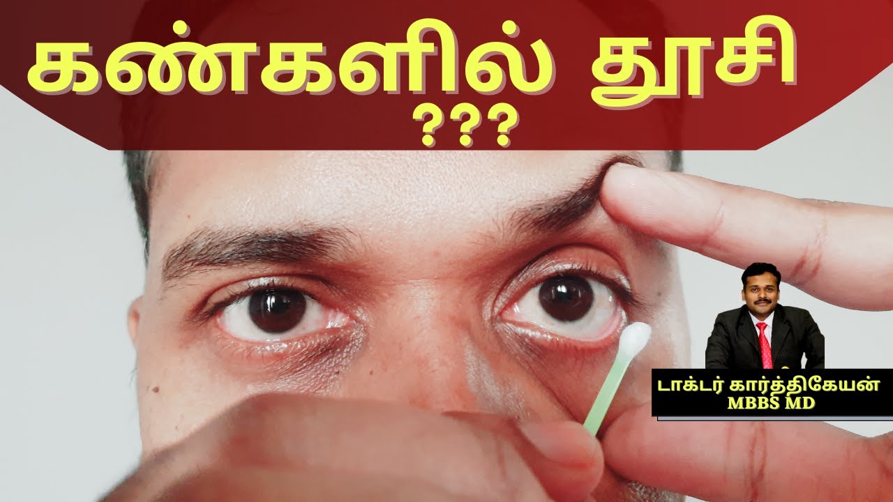 How to remove dust and clean the eyes in tamil by doctor karthikeyan