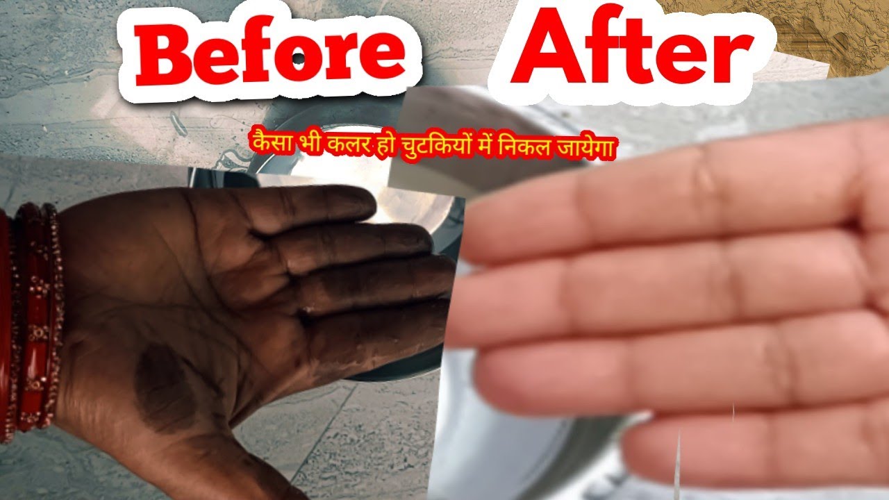 How to Remove Hair Dye from skin |घंटो का काम मिंटो अब |डाइ हाथो से निकले चुटकियों मे ये ट्रिक देखलो