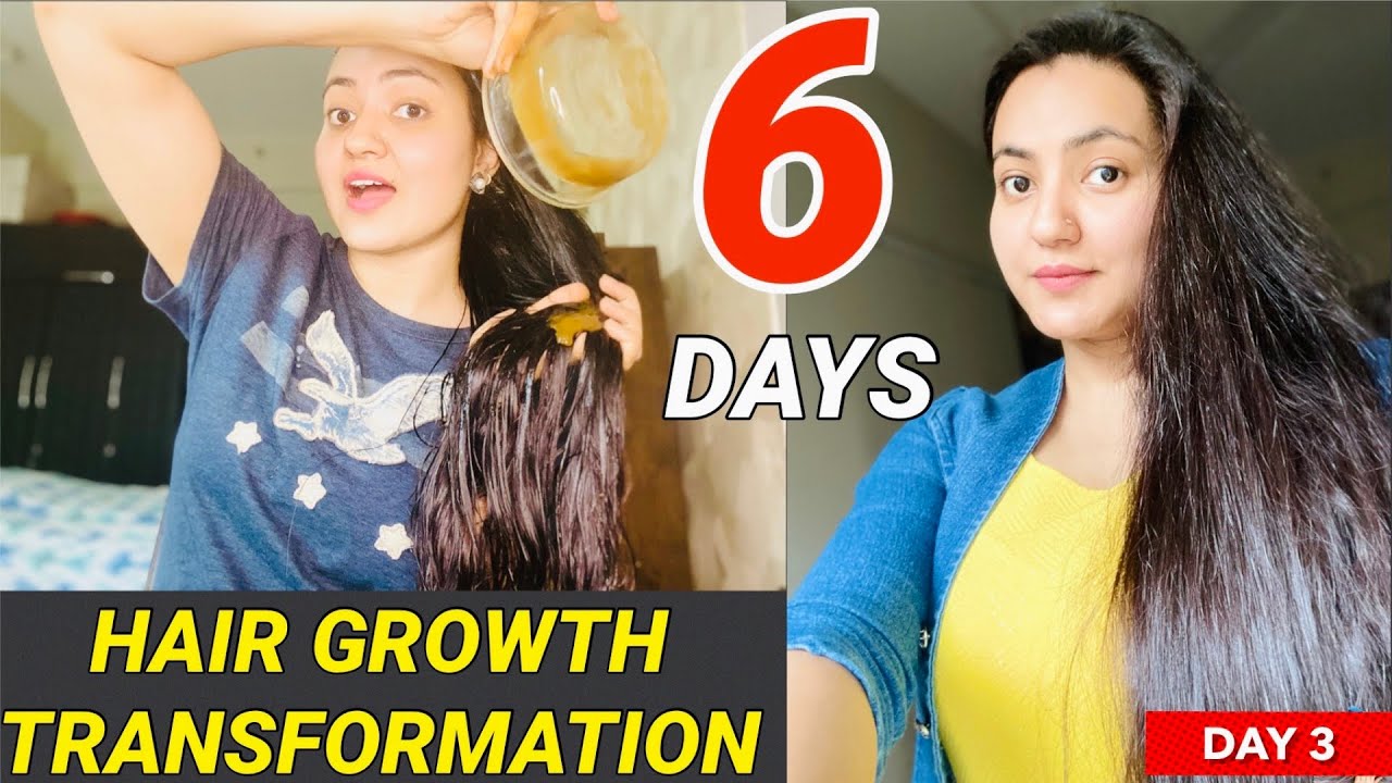 6 DAYS HAIR GROWTH TRANSFORMATION SERIES : Hair Re-Growth और Long Thick Hair अब मुमकिन हैं