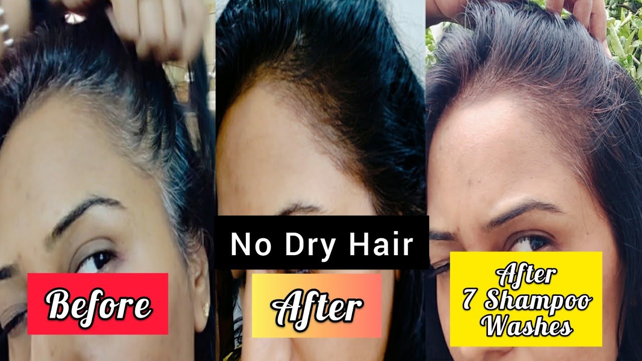Grey Hair 1 ही बार में Black करें Ayurvedic & Natural तरीके से | 💯 Honest | Sesa Natural Hair Colour