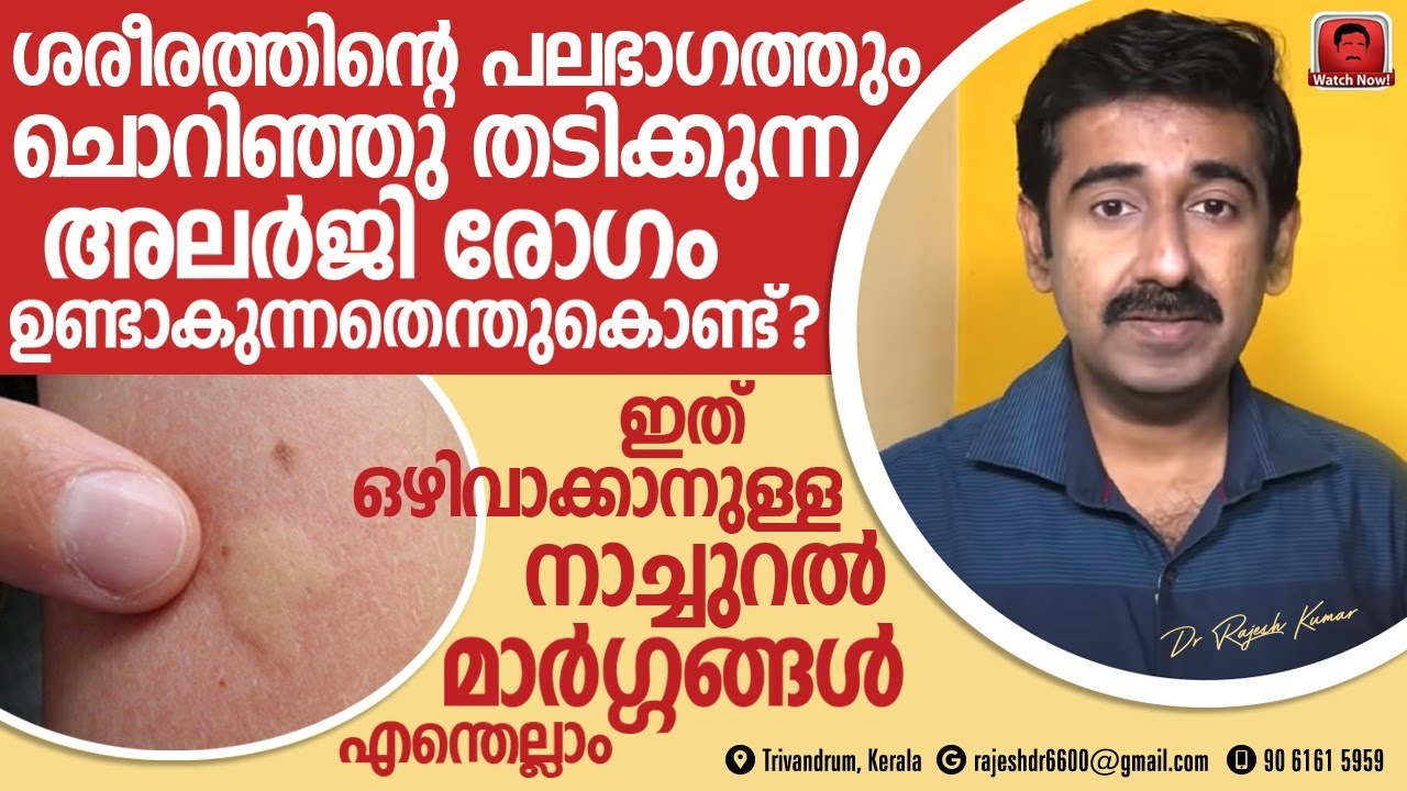 ശരീരത്തിൽ ചൊറിഞ്ഞു തടിക്കുന്ന അലർജി ഉണ്ടാകുന്നതെങ്ങനെ ?ചൊറിച്ചിലും അലർജിയ്ക്കും നാച്ചുറൽ മാർഗ്ഗങ്ങൾ