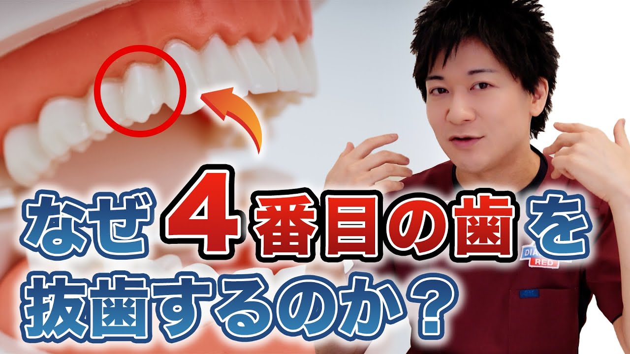 【歯列矯正】なぜ矯正治療で4番目の歯を抜くのか？歯科医師が解説