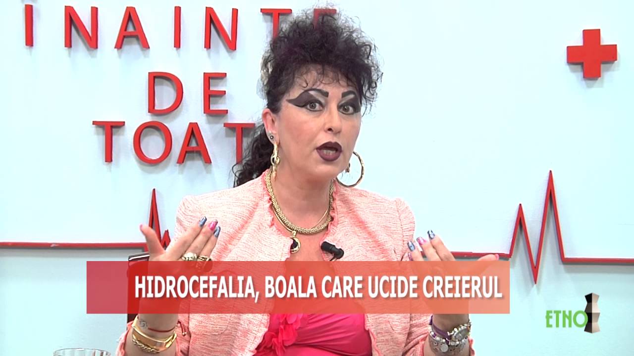 EMISIUNE SANATATE   EMILIA LUNGUT   HIDROCEFALIA   10.05.2016