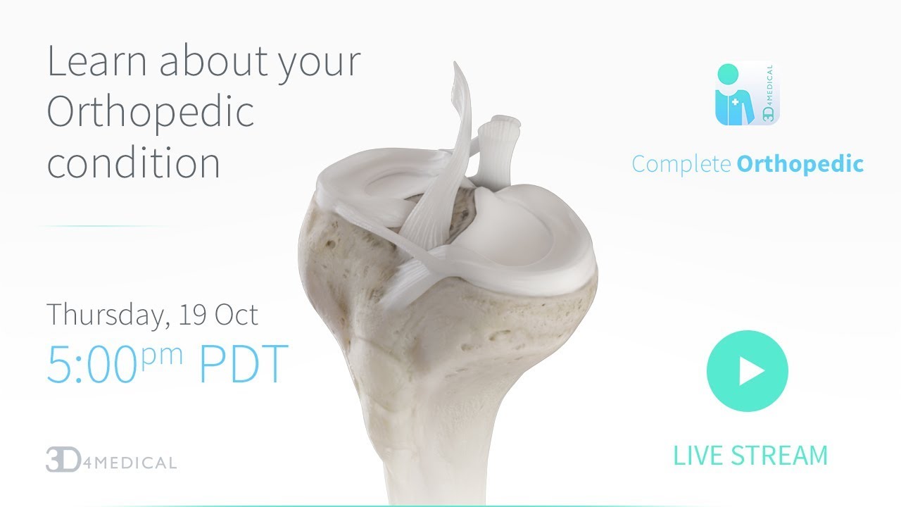 Learn about your orthopedic condition