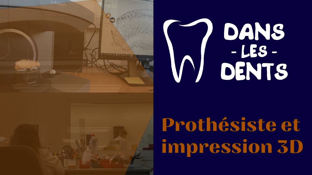 Prothèses, prothésiste et impression 3D