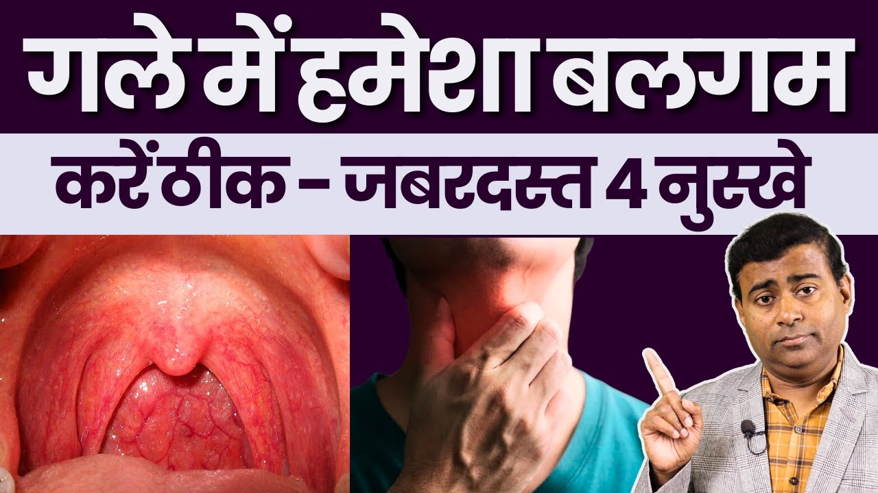 गले में हमेशा बलगम रहता है यह 4 चीजे अपना कर ठीक करें Treatment of Constant cough #pnd