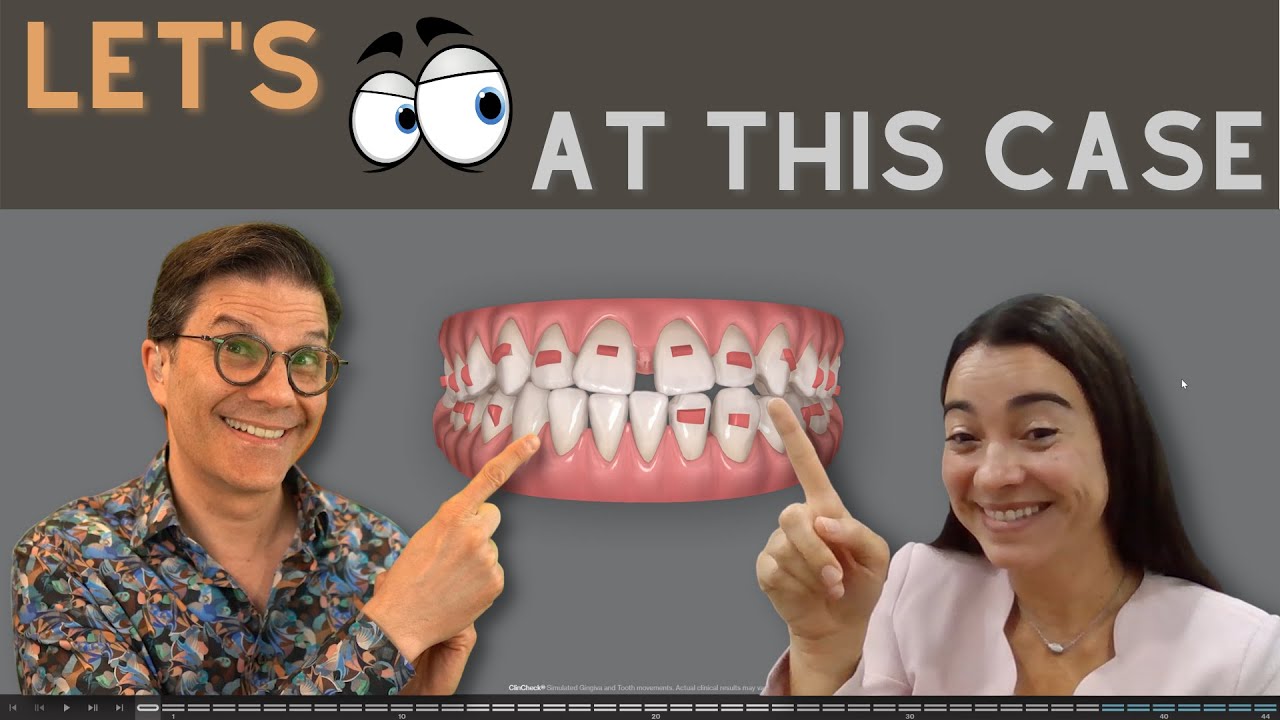 Как составить план лечения Invisalign ClinCheck?
