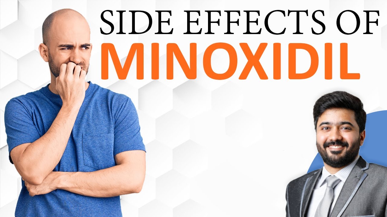 Side Effects Of MINOXIDIL | MINOXIDIL Se Balon Par Kya Asar Padhta Hai | By Our Hair Expert