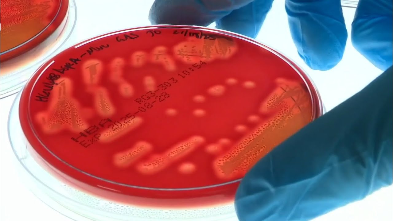 Nipah virus prompts heightened border security in Asia as two cases detected in India