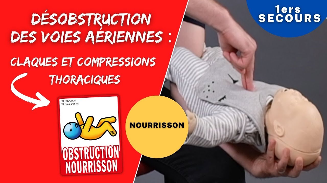 Etouffement du NOURRISSON : les techniques de DÉSOBSTRUCTION  ı Formation premiers secours