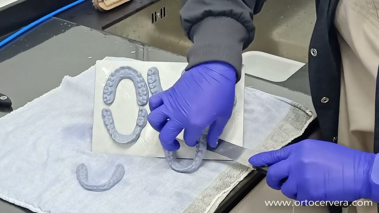ORTOCERVERA/Ortodoncia: Postprocesado de impresiones 3D - lavado y curado.