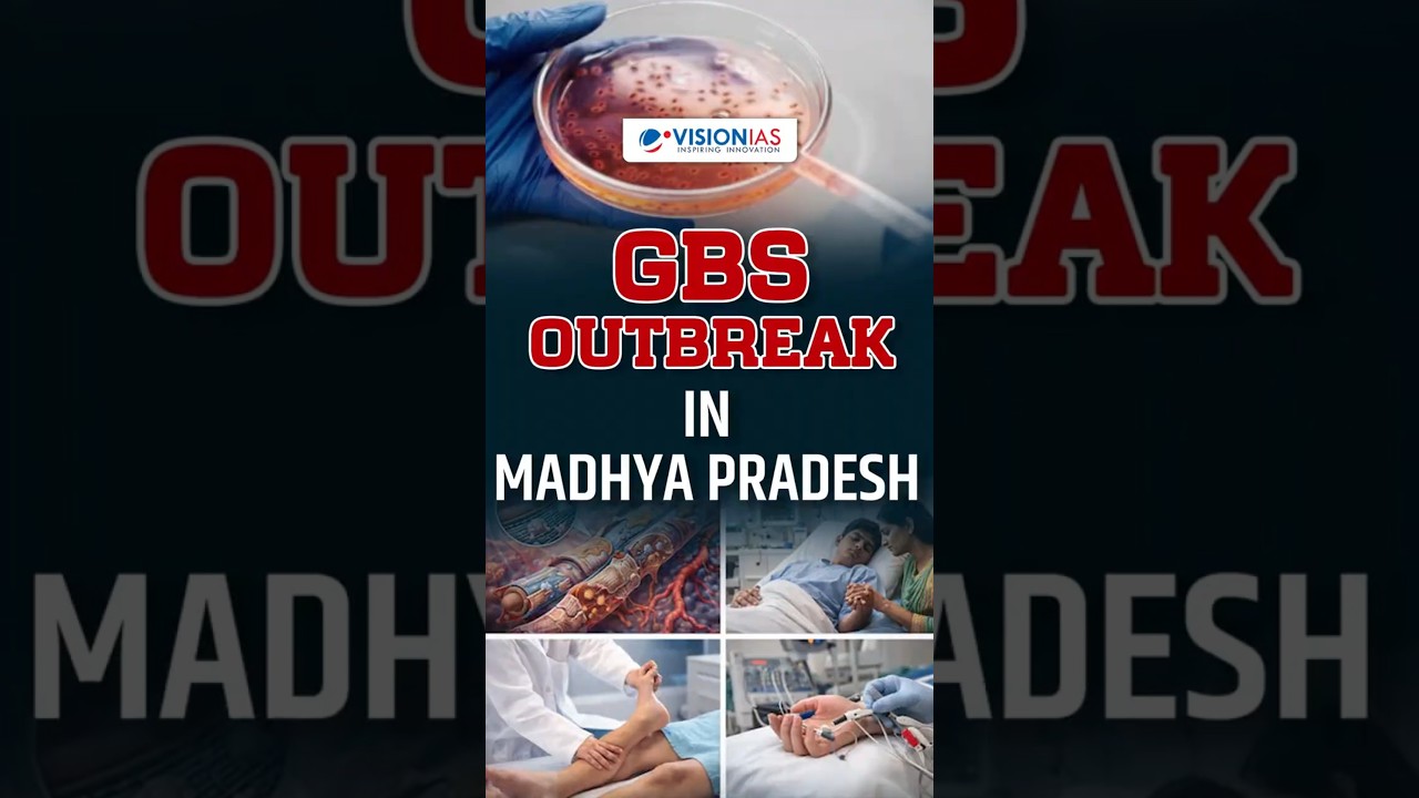 GBS Outbreak in Madhya Pradesh’s Neemuch: 2 Children Dead, More than 10 New Cases