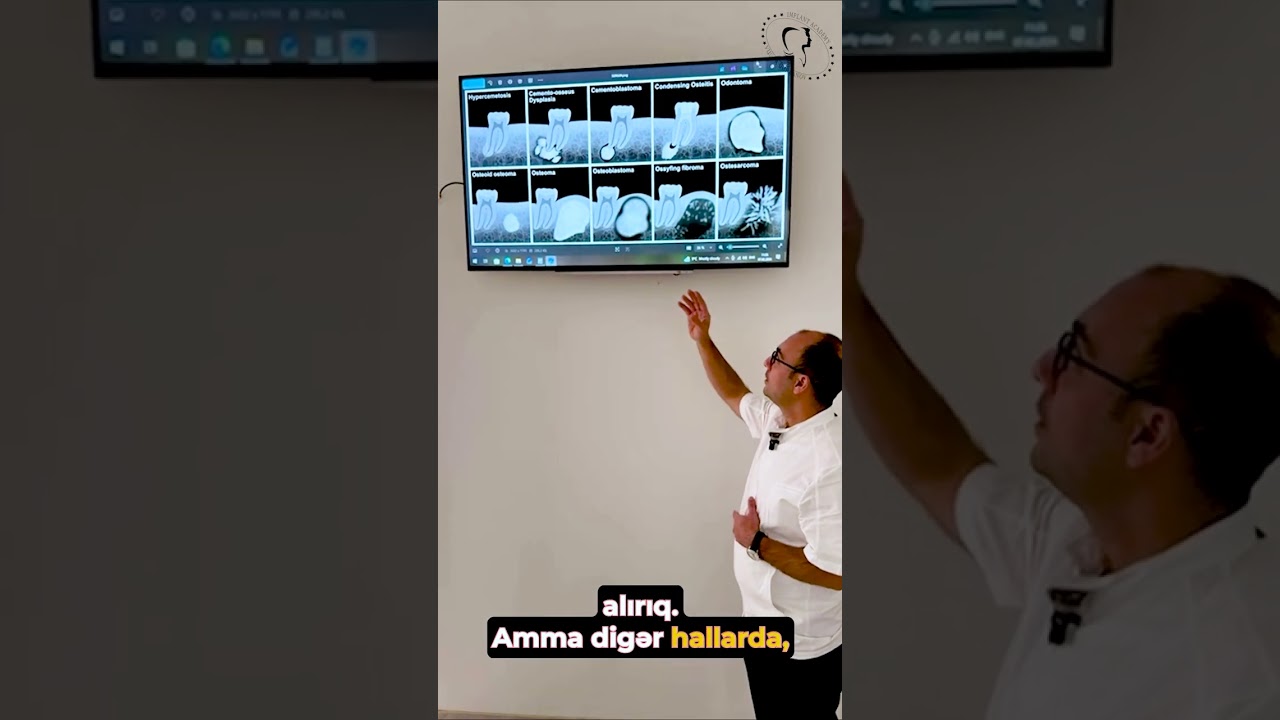 Hər radioloji kölgə əməliyyat demək deyil