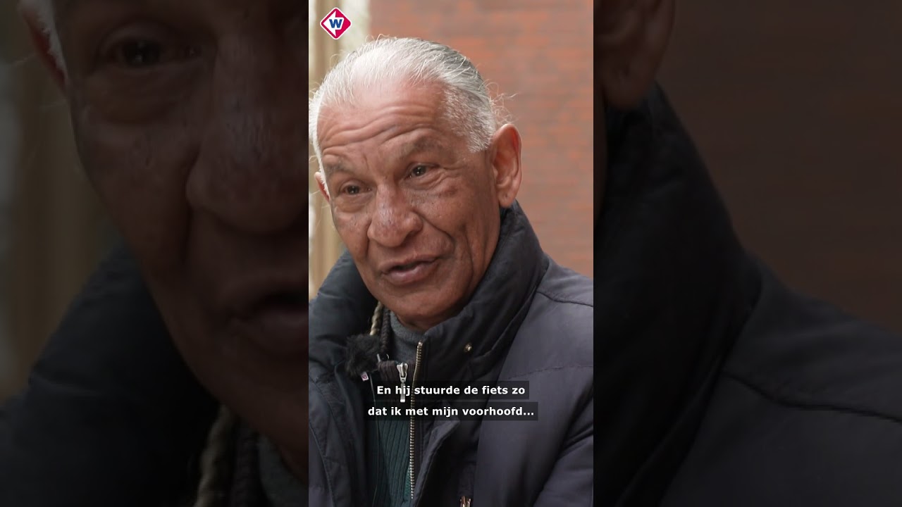 Tanden los en gezicht kapot na straatroof | #shorts