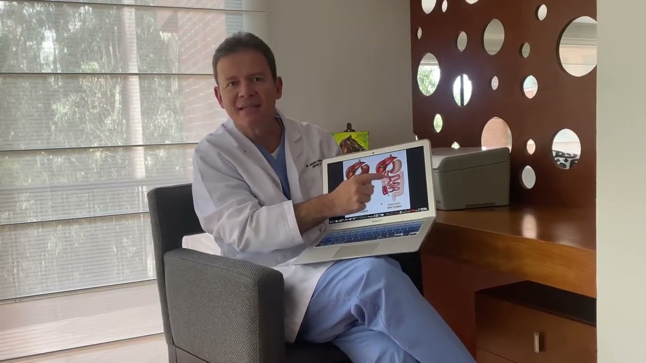SADIS  Bariatric Surgery / Cirugia Bariatrica SADIS www.medinetco.com #plasticsurgeon #beauty