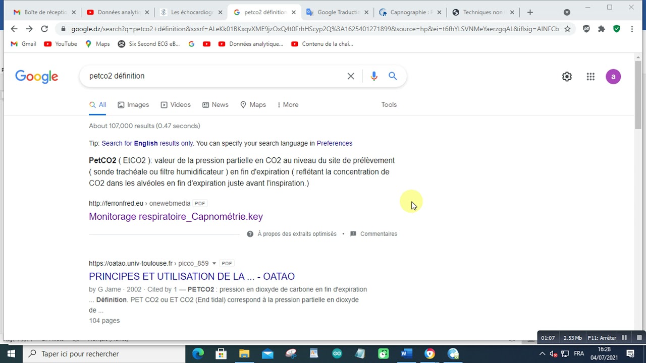 PetCO2 ( EtCO2 ): valeur de la pression partielle en CO2 au niveau du site de pr&eacute;l&egrave;vement