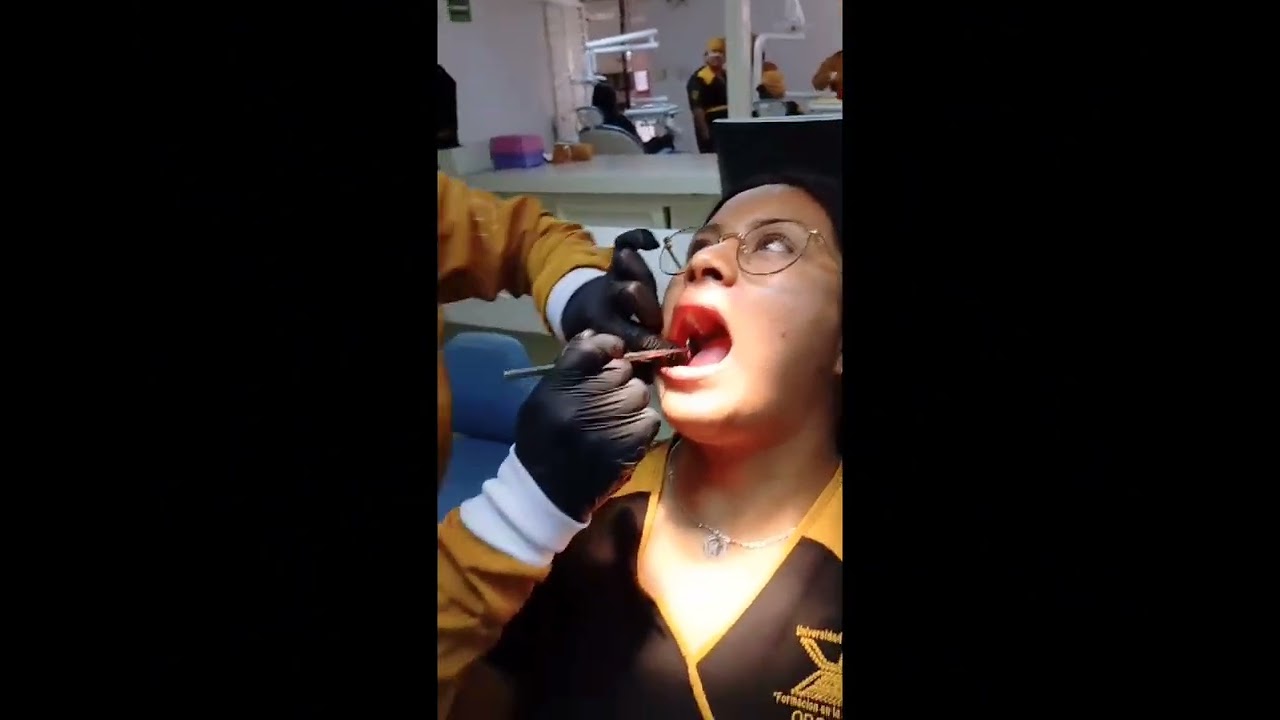 patología bucal 