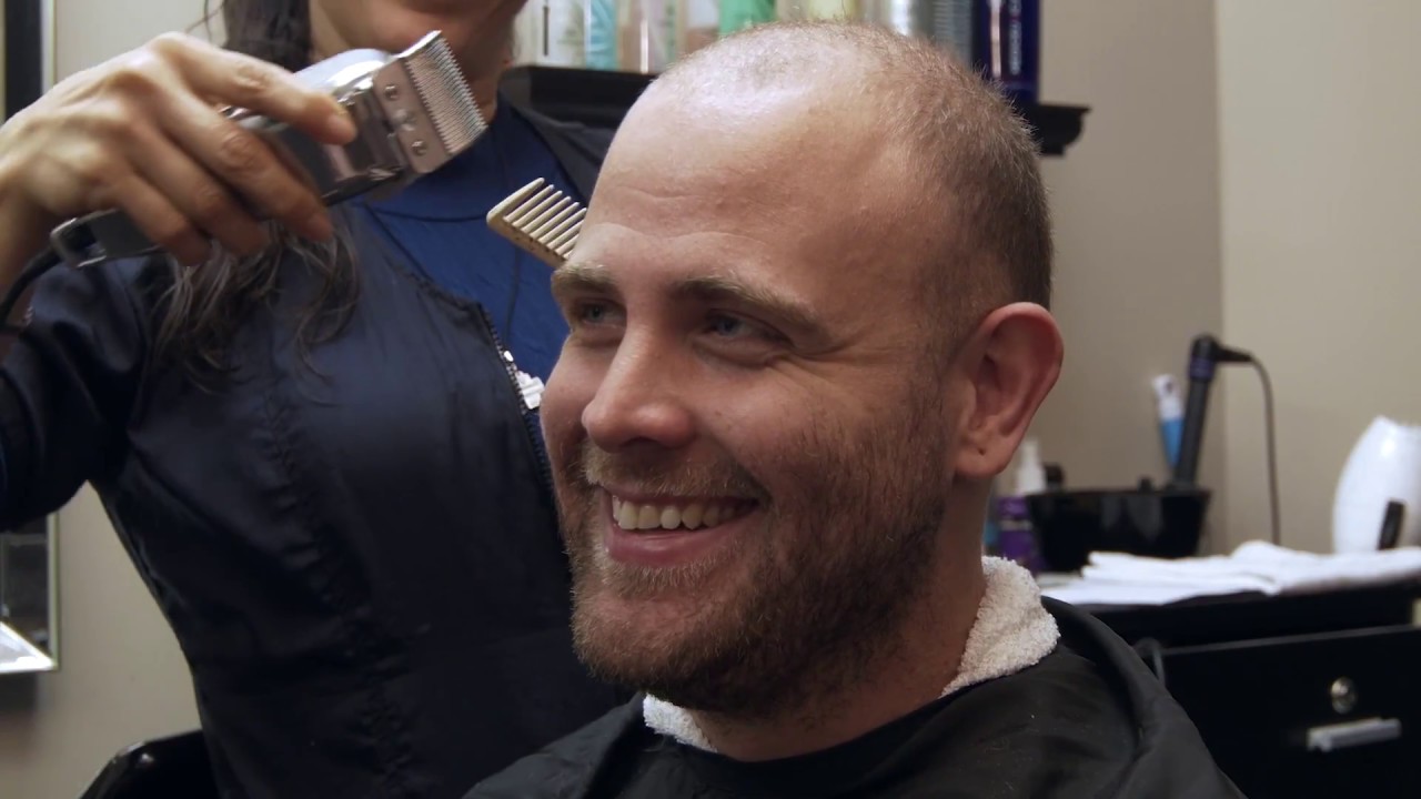 TM Hair Client James getting new hair for the first time