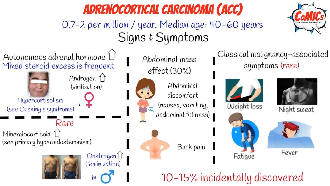 CoMICs Episode 5: Adrenocortical Cancer
