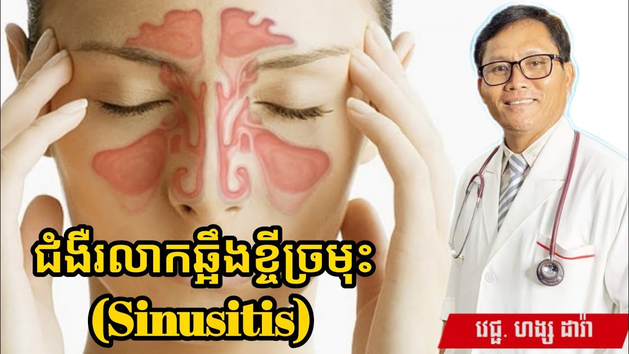 ជំងឺរលាកឆ្អឹងខ្ចីច្រមុះ (Sinusitis)  | វេជ្ជបណ្ឌិត ហង្ស ដារ៉ា | ចំណេះដឹងសុខភាព | success knowledge