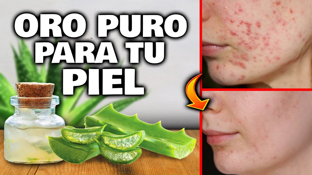 Aplica SÁBILA o ALOE VERA en tu cara A DIARIO y MIRA que OCURRE!! Elimina ARRUGAS, MANCHAS y ACNÉ