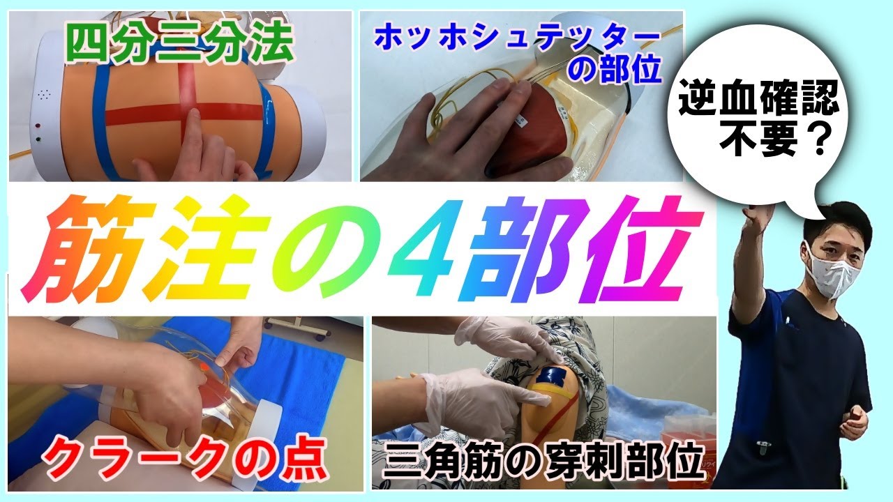 【臨床ですぐ使える】筋肉内注射の部位特定４つ｜安全に行うための実践ポイント | 逆血確認は必要か？不要か？
